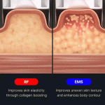 AGE-R Contour Body Shot